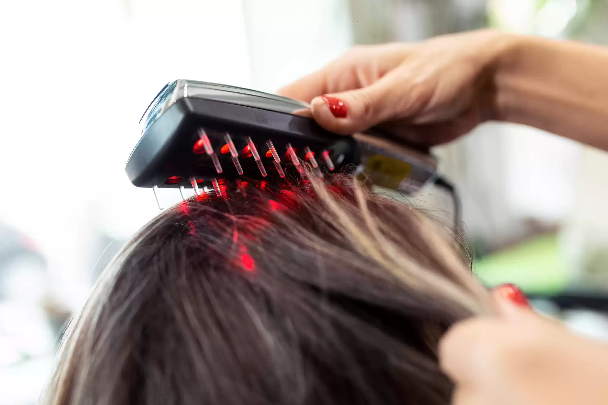 tratament laser păr