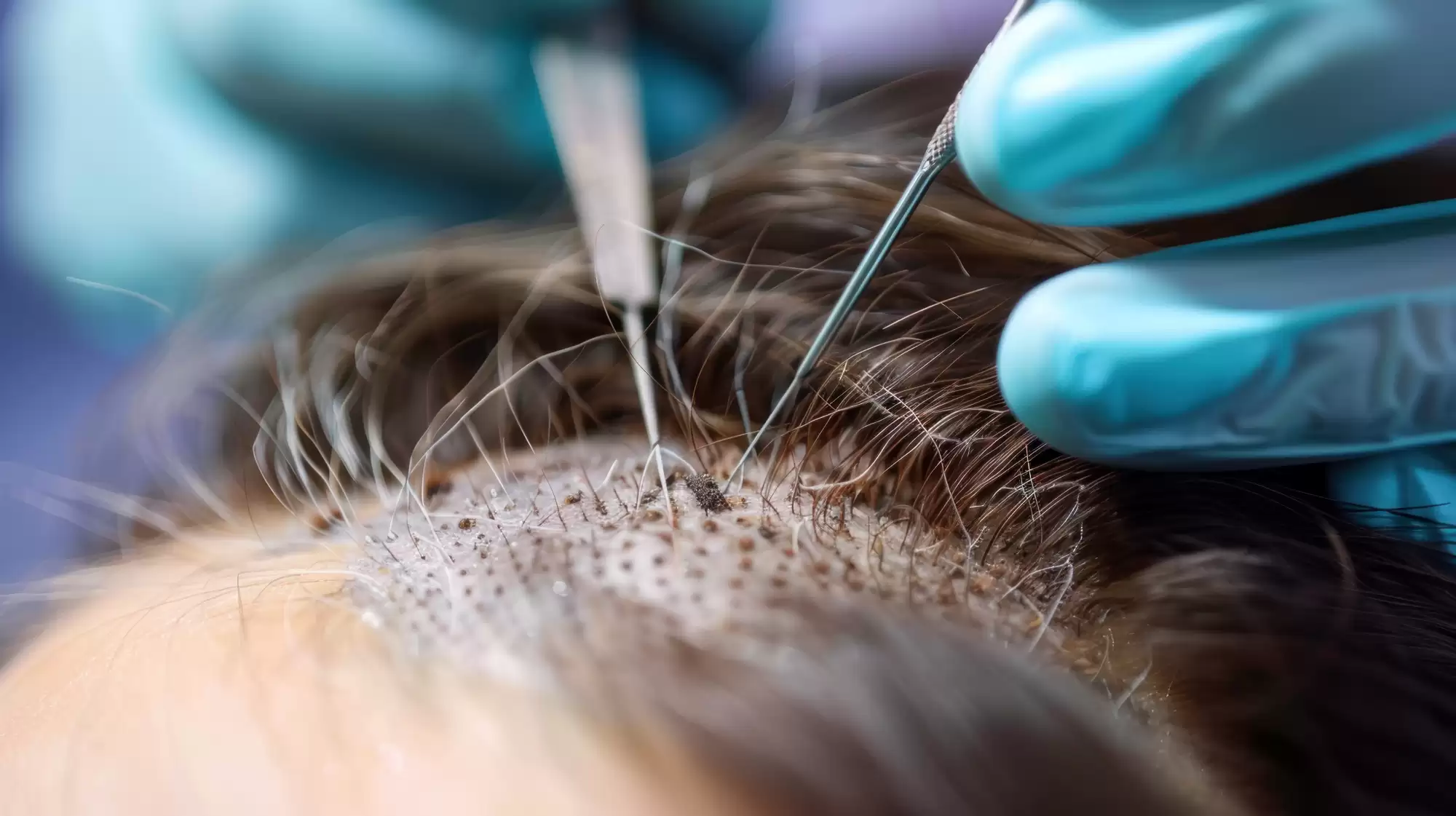 tratamente pentru creșterea părului