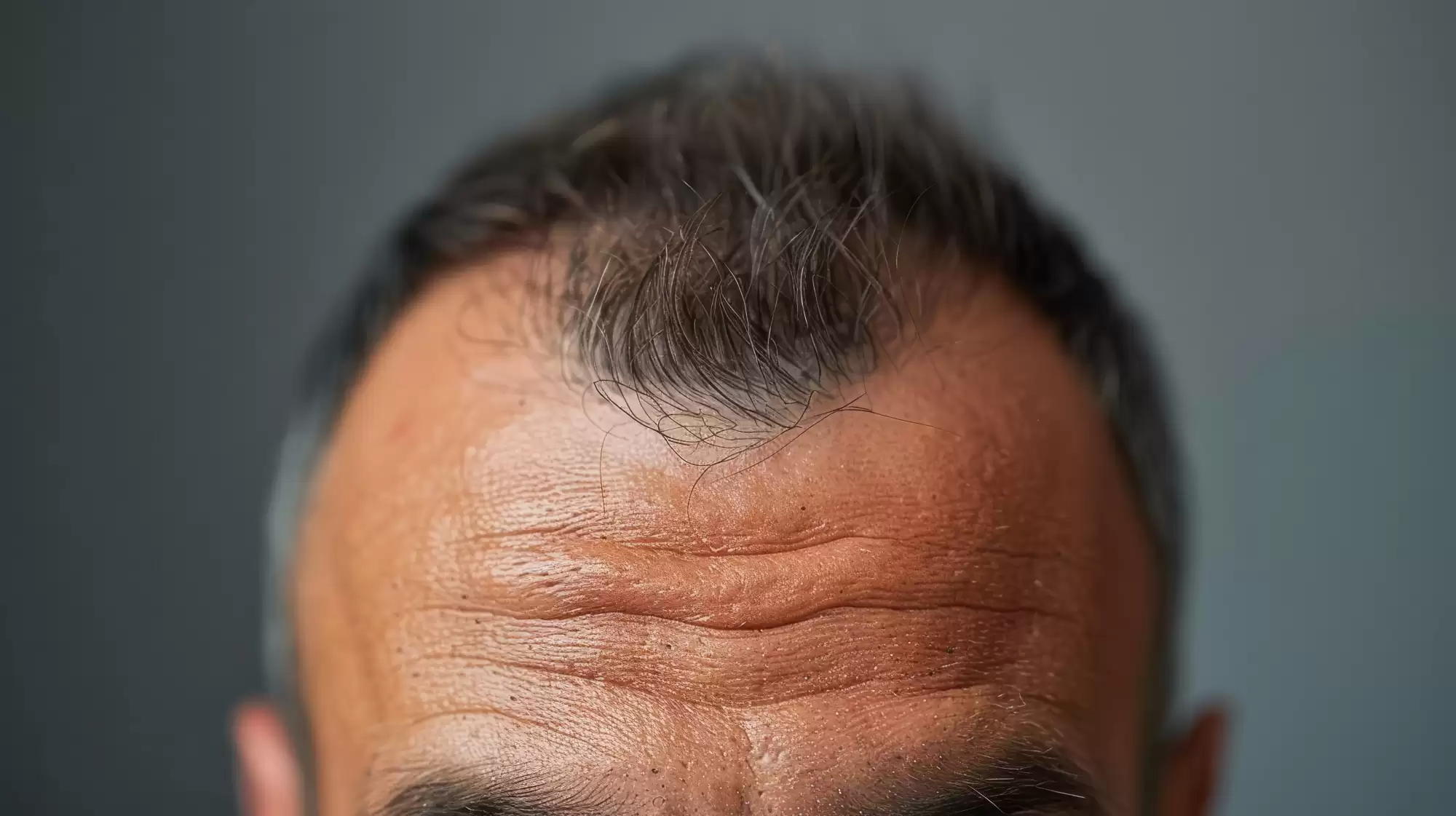 tratament exozomi păr